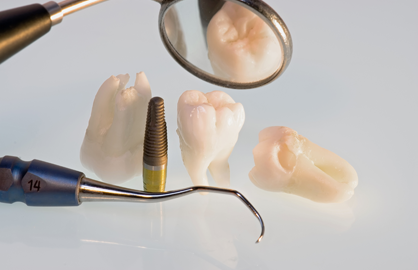 四街道駅・OSHIMA DENTAL OFFICE(オオシマデンタルオフィス)・その他の不具合